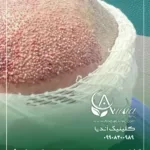 کاشت مو در تهران شهرک غرب - کلینیک اندیا