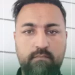 کاشت مو سر در تهران - به روش میکروگراف