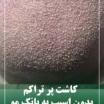 کاشت پر تراکم مو ی سر در تهران شهرک غرب کینیک اندیا