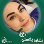بعد از عمل چشم آهویی - عکس بعد از عمل چشم آهویی