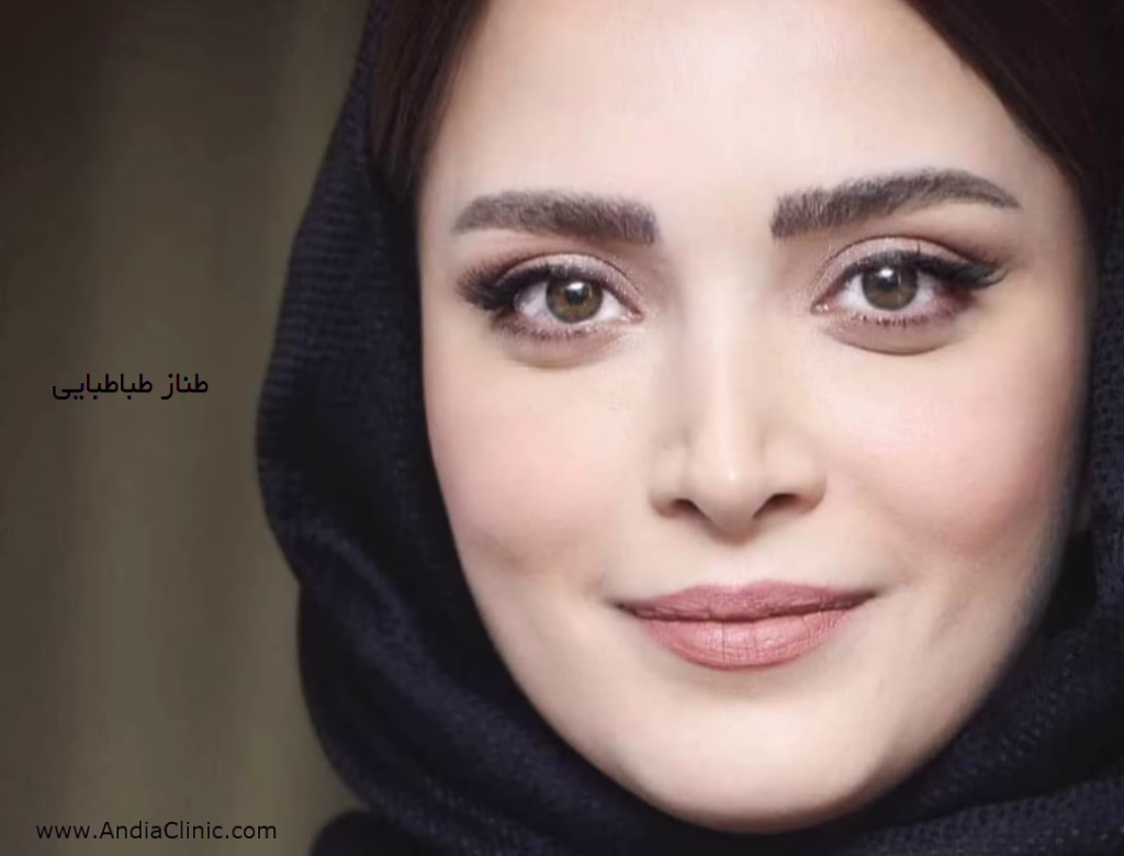 طناز طباطبایی - مدل چشم آهویی