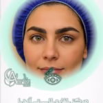 بلفاروپلاستی
