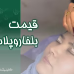 قیمت و هزینه بلفاروپلاستی