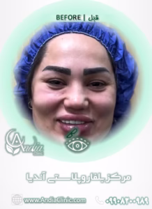 چشم گربه ای بدون آرایش