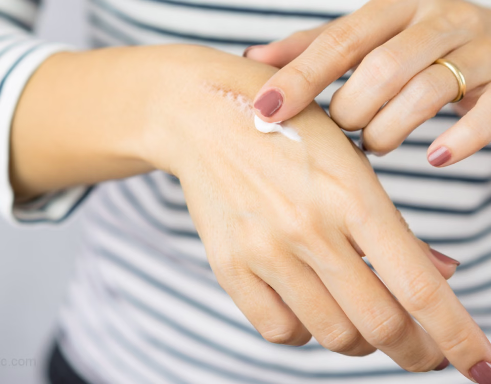 کرم ترمیمی جای زخم